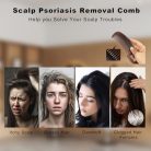 Dandruff Comb korpásodás elleni fésű 21,1 × 5,3 cm fejbőr psoriasis és tetű fésű - outlet termék