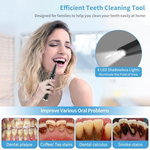 Visual fogkefe | szájzuhany és tartozékok - 3 sebességes fogtisztítás, ideális fogkő - outlet termék