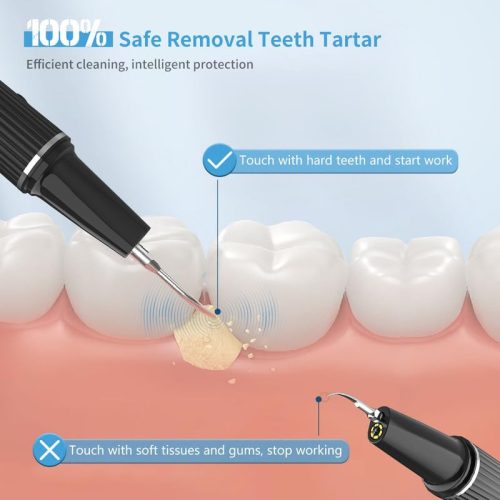Visual fogkefe | szájzuhany és tartozékok - 3 sebességes fogtisztítás, ideális fogkő - outlet termék