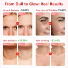 USUIELIGHT LED arcmaszk fényterápia, 7 színű LED maszk arcra és nyakra anti-aging - outlet termék