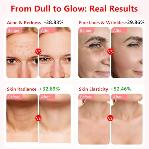 USUIELIGHT LED arcmaszk fényterápia, 7 színű LED maszk arcra és nyakra anti-aging - outlet termék